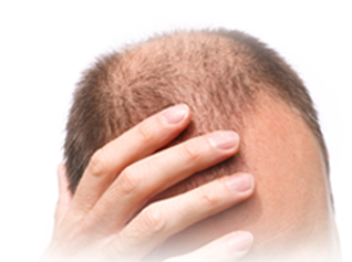 Hair Loss Miracle Solution