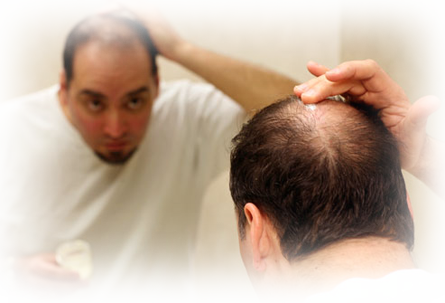 Hair Loss Miracle Solution